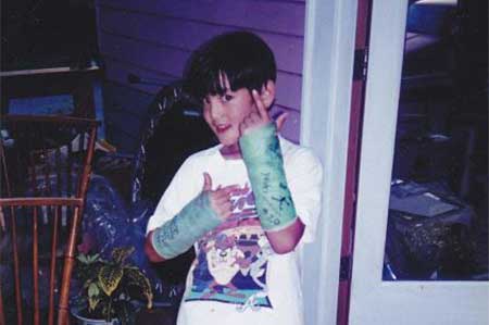 Taiyo as a child with 2 broken wrists